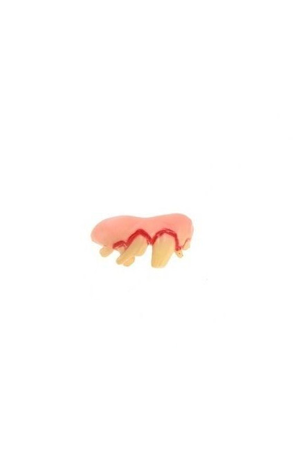 Гнилые зубы кривые